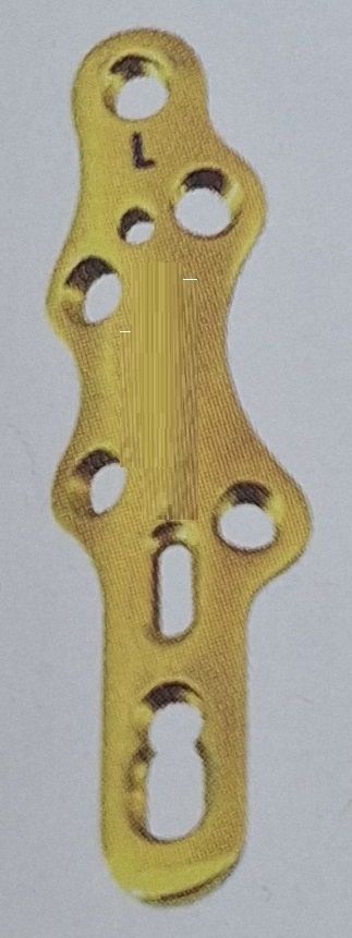 TM Bauer’s Synthes Пластина для артродезу 1-го плеснофалангового суглоба, ліва